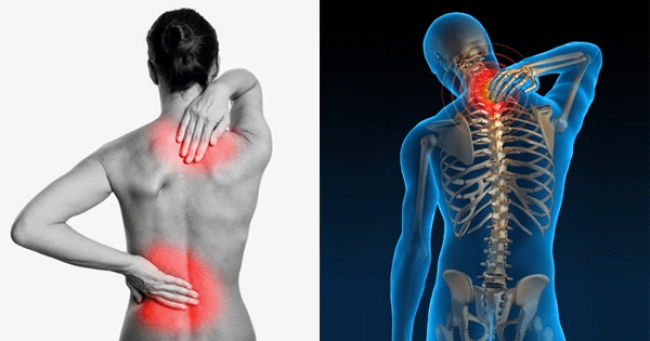 En el Día Mundial de la Columna, ocho consejos para evitar sufrir dolores de espalda